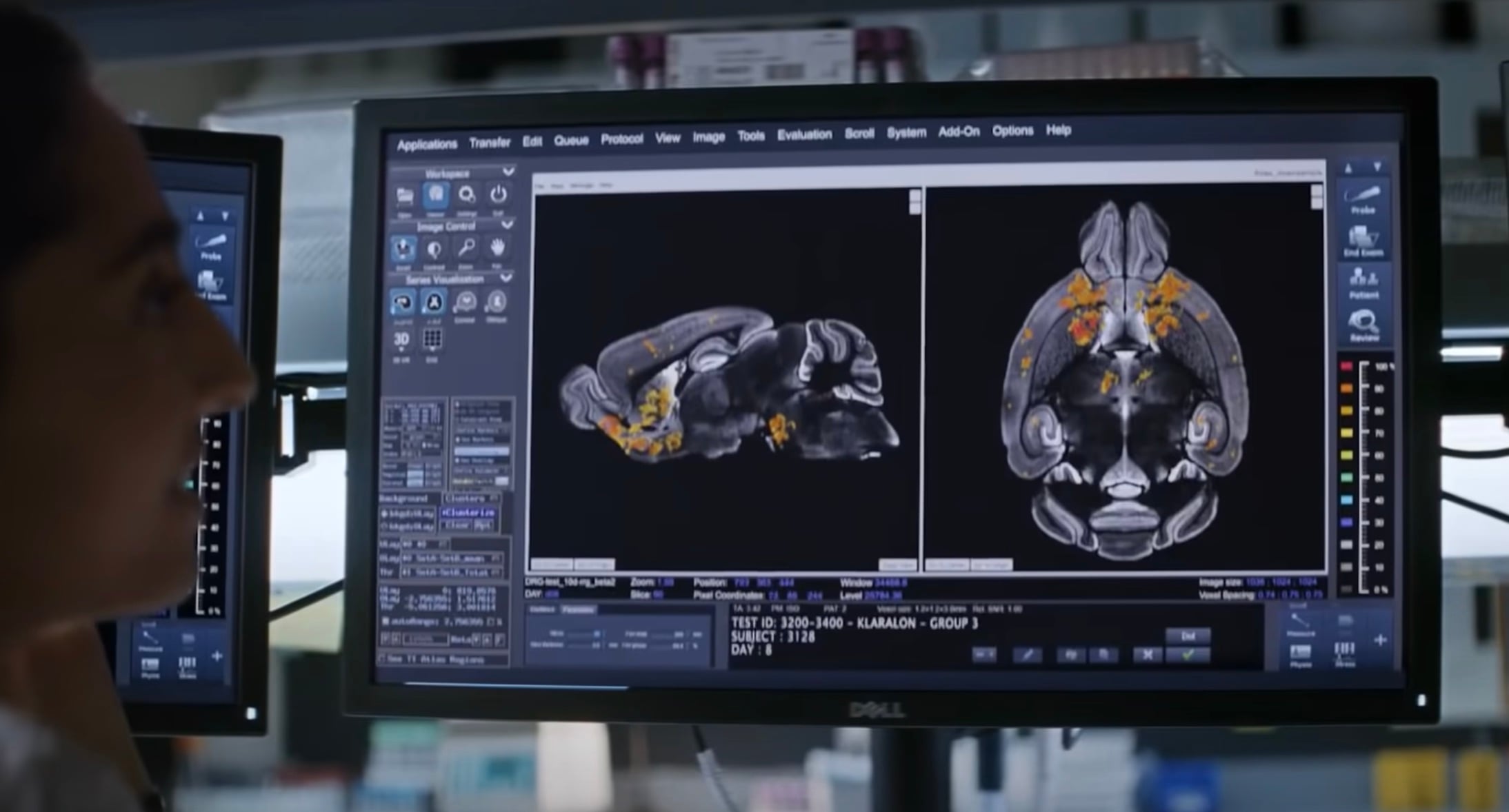 8 Best Lily Rose Depp Movies And Tv Shows